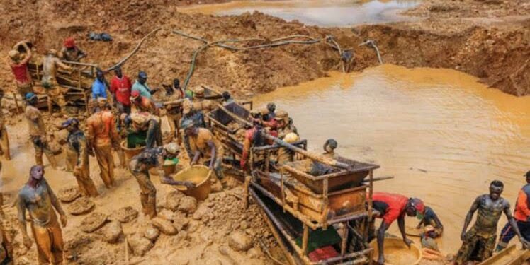 Radiologists kidney galamsey