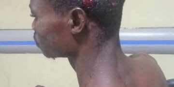 Sagnarigu MP calls for calm in Damankuniyili-Nyeshee disturbances